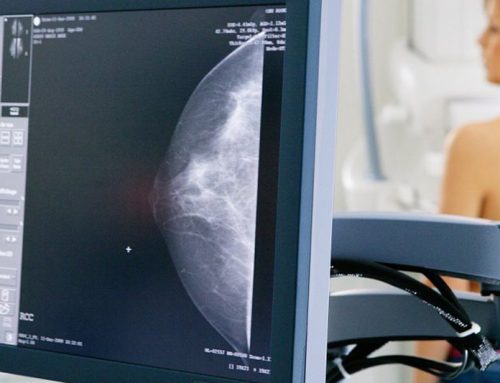 Mamografía Digital 3D: qué es, para qué sirve y cuándo realizarla