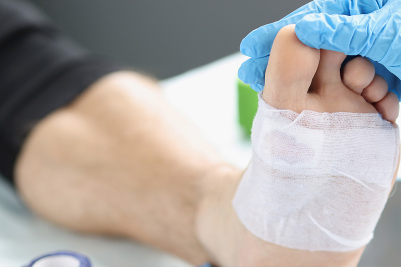 Síntomas de una infección en la piel