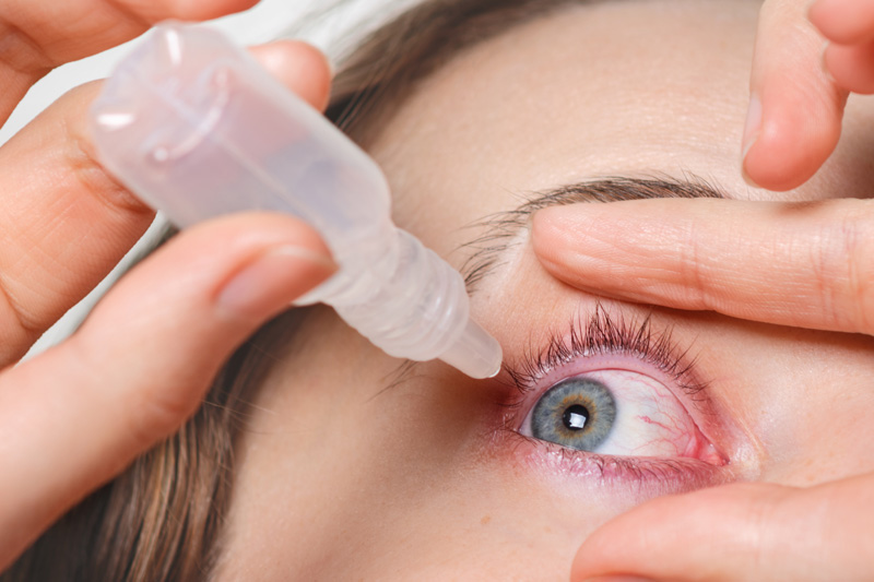 Síndrome de Sjogren síntomas